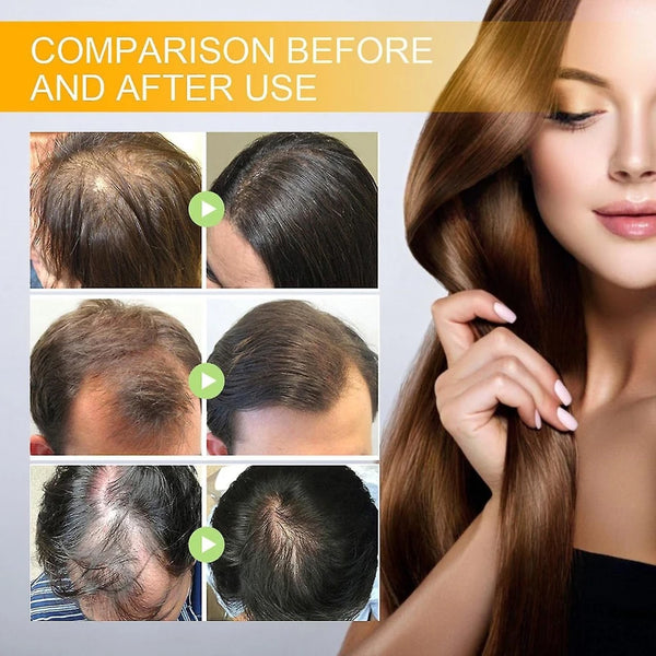 Orvexa Skin Tag Cryotherapy Removal Spray