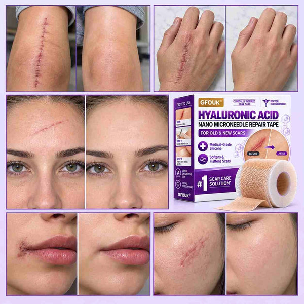 ScarLuxe Advanced Nano Microneedle Scar Care Tape