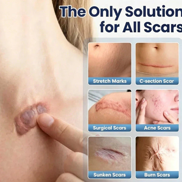Scar Repair Cream