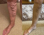 ODALIT Vein Therapy Cream