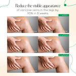 ODALIT Vein Therapy Cream