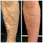 ODALIT Vein Therapy Cream