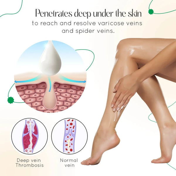ODALIT Vein Therapy Cream