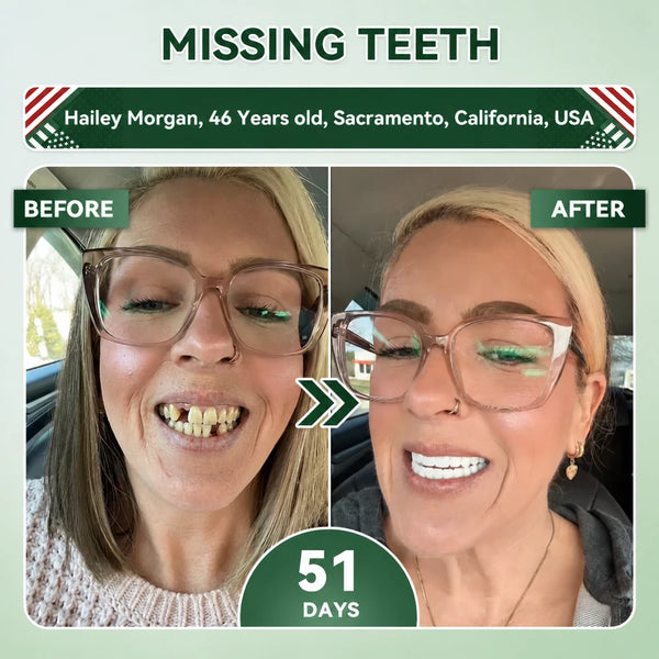 SmileRenew Dental Repair Strips