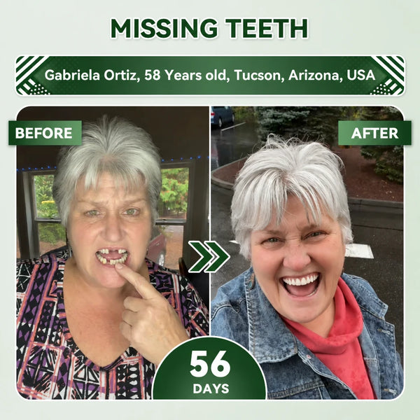 SmileRenew Dental Repair Strips