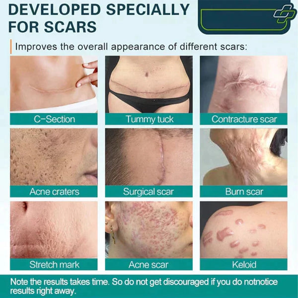 LOVILDS Advanced Scar Healing Spray