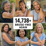 Bruiseshield Skin Strengthening Cream