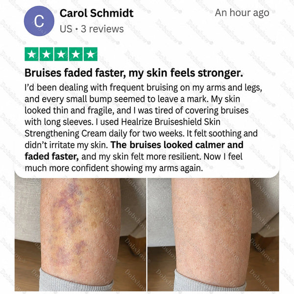 Bruiseshield Skin Strengthening Cream