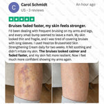 Bruiseshield Skin Strengthening Cream