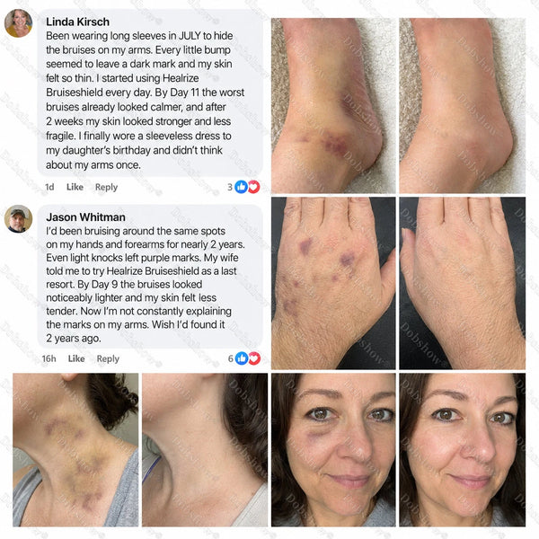 Bruiseshield Skin Strengthening Cream