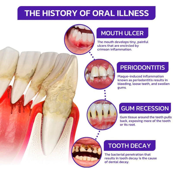 Bee Venom Toothpaste for Sensitive Gums