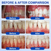 GumShield Periodontal Care Gel