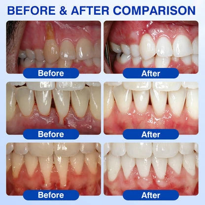 GumShield Periodontal Care Gel