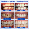 GumShield Periodontal Care Gel