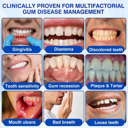GumShield Periodontal Care Gel