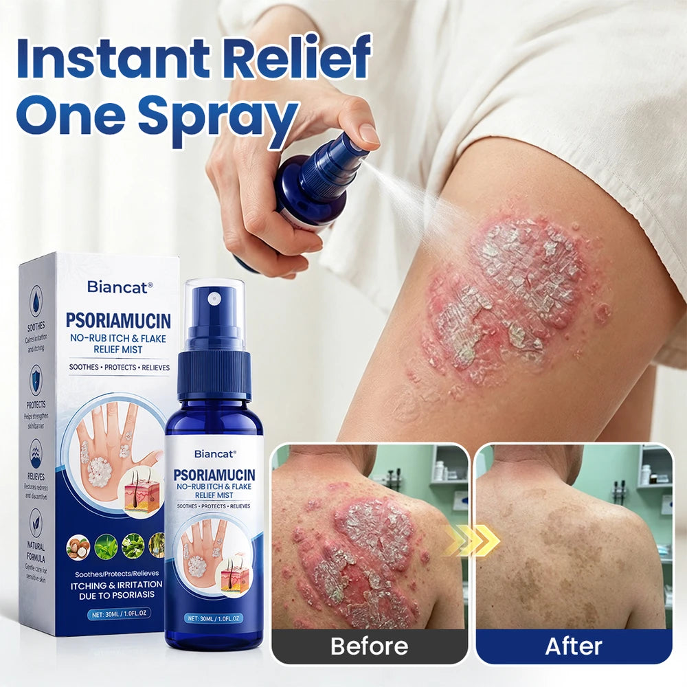 Biancat PsoriaMucin Relief Mist