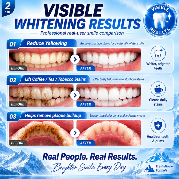 Foam Bright Whitening Foaming Toothpaste