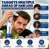 Reverse Hair Growth Serum