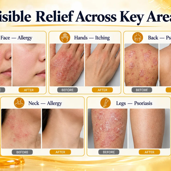 DermaVelle 24-Hour Skin Renewal Gel