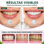 Sensitive Teeth Repair Gel
