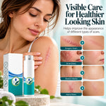 Advanced Scar Spray
