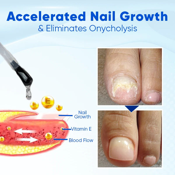 Nailvique Advanced Nail Growth &amp; Repair Serum