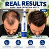 Reverse Hair Growth Serum