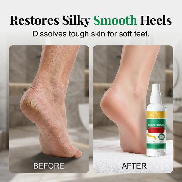 Fresh Sole Foot Mist