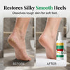 Fresh Sole Foot Mist