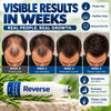 Reverse Hair Growth Serum