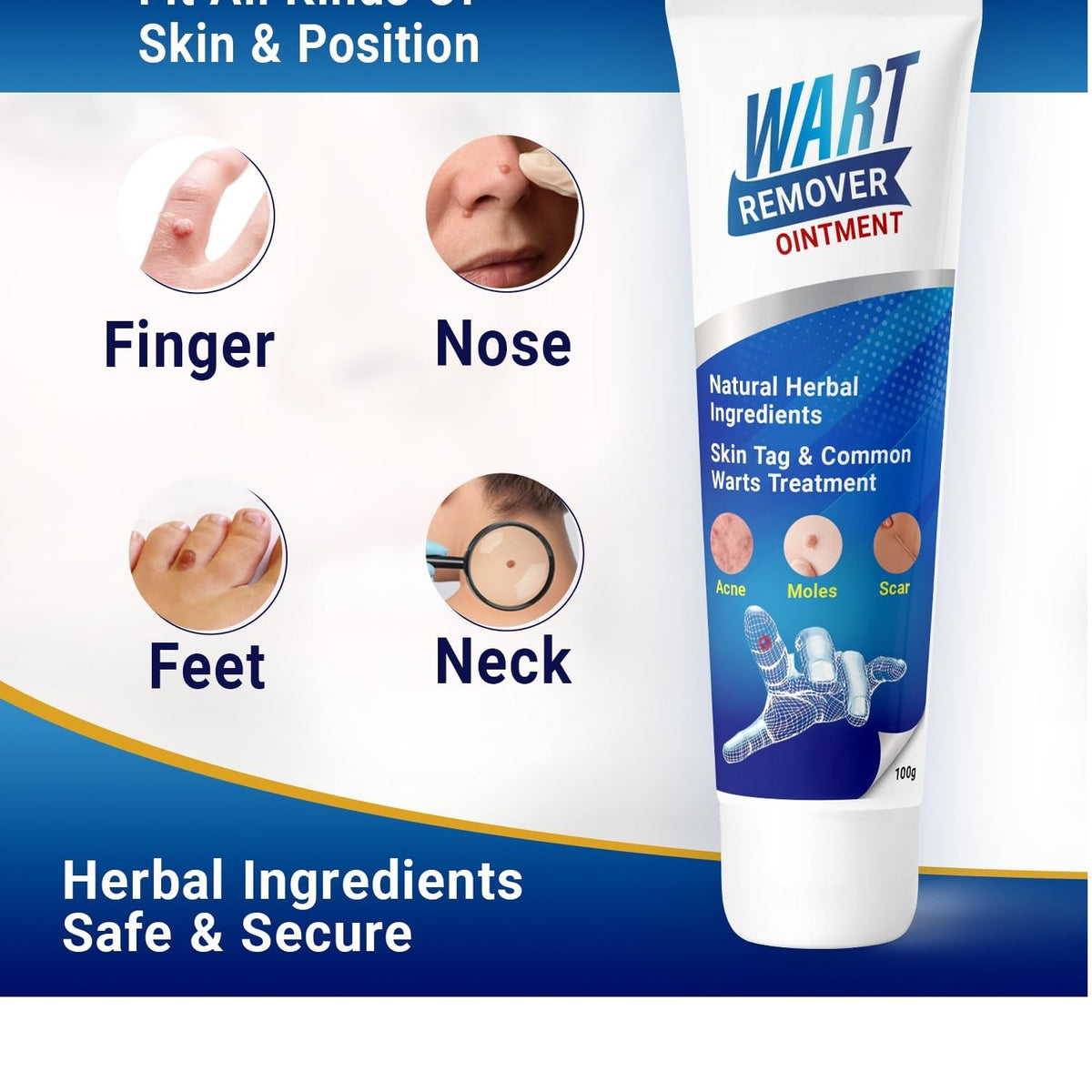 Mole & Wart remover ointment