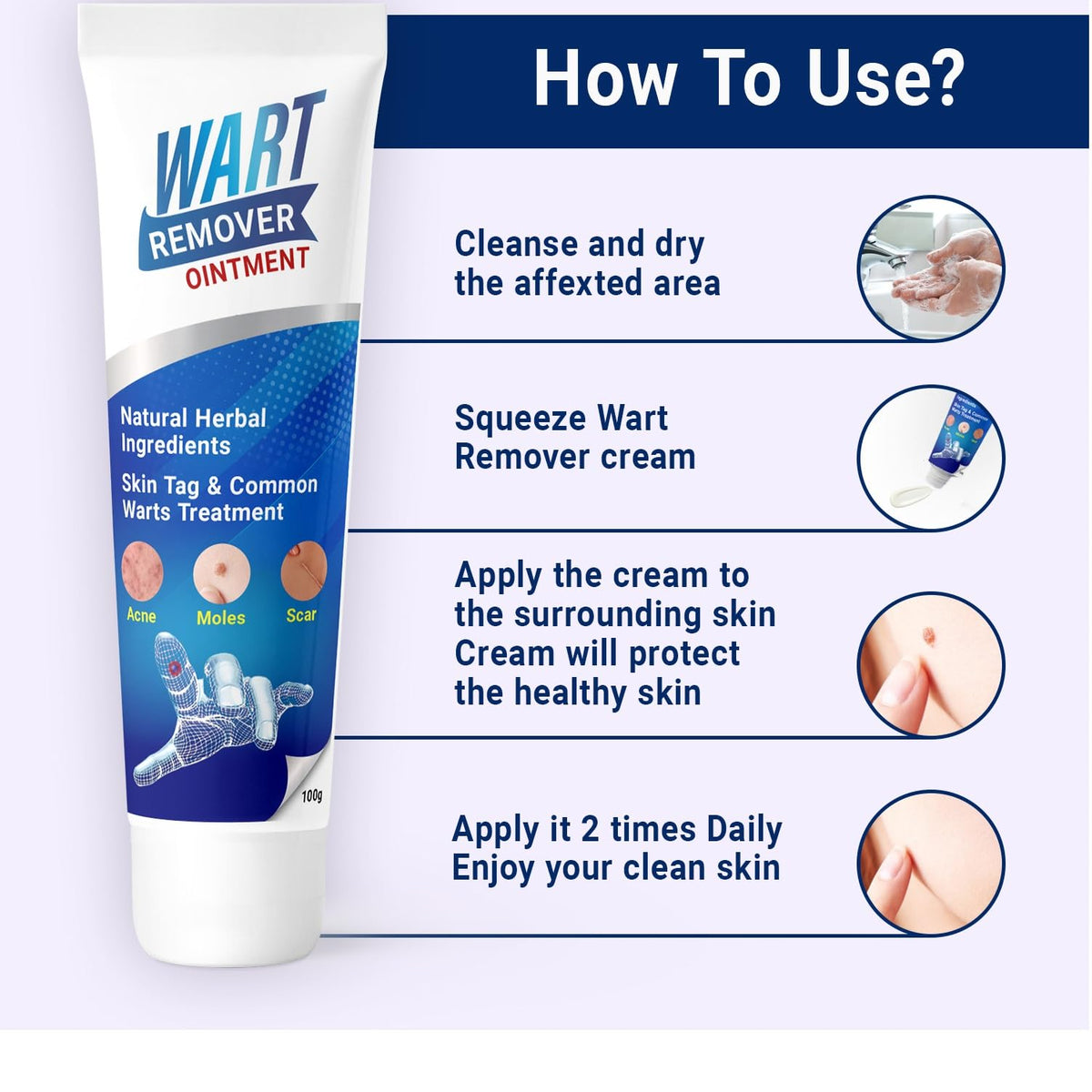 Mole & Wart remover ointment