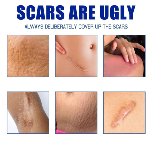 Scar Repair Gel