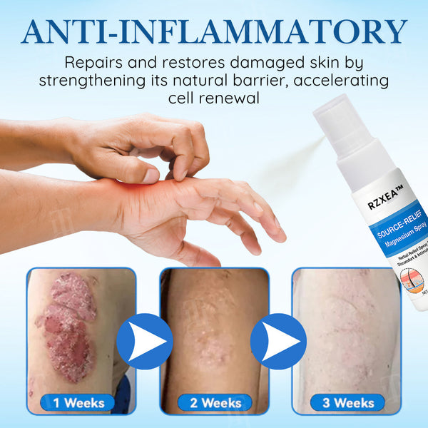 Rapid Relief Magnesium Spray