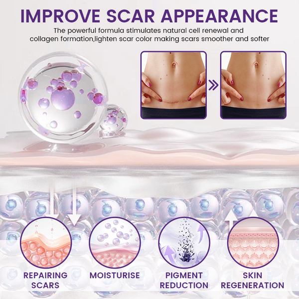 ReGenScar Advanced Scar Gel