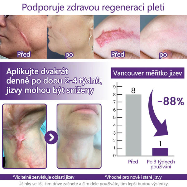 ReGenScar Advanced Scar Repair Gel