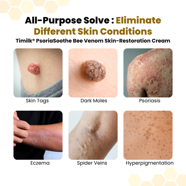 PsoriaSoothe Bee Rescue Cream