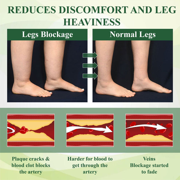 FluidEase Leg Therapy Cream