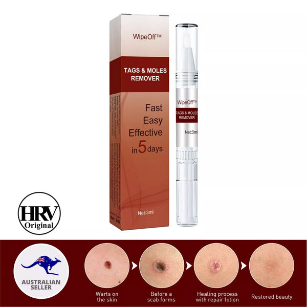 Skin Tags Moles Wart Remover Liquid Pen