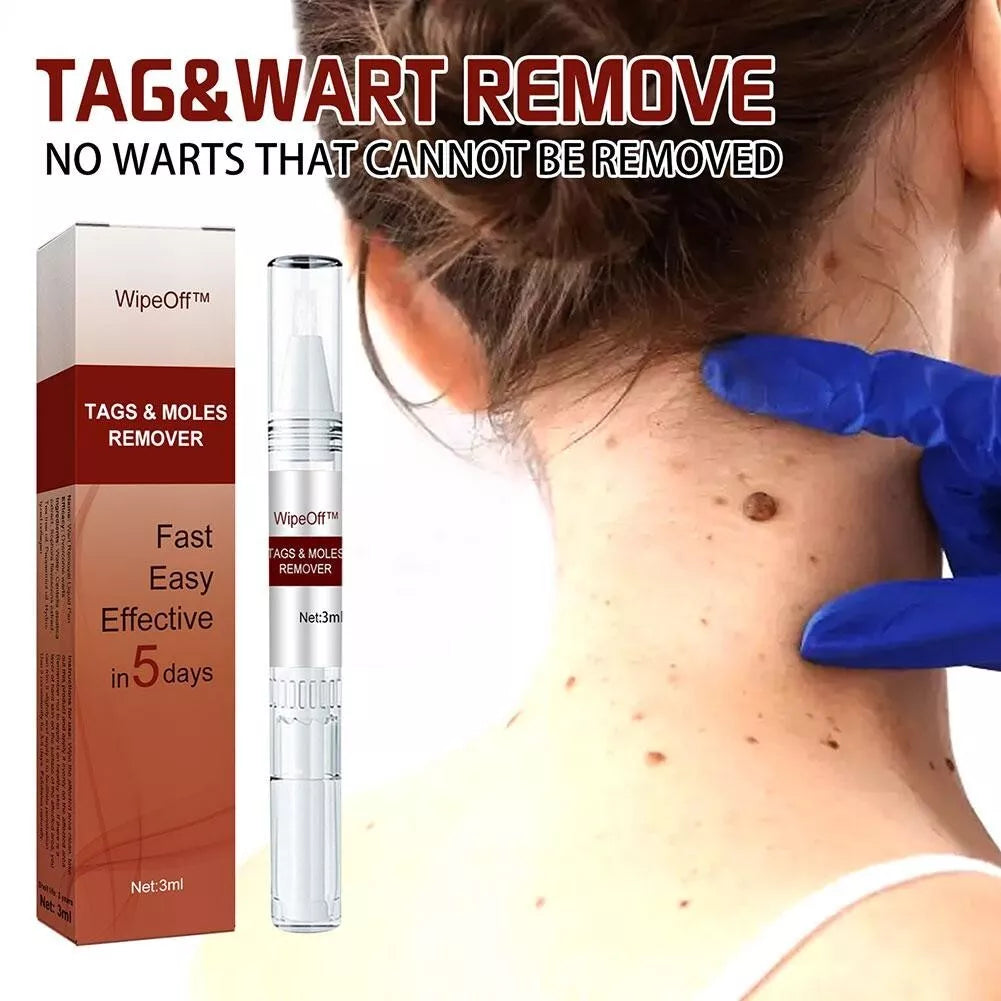 Skin Tags Moles Wart Remover Liquid Pen